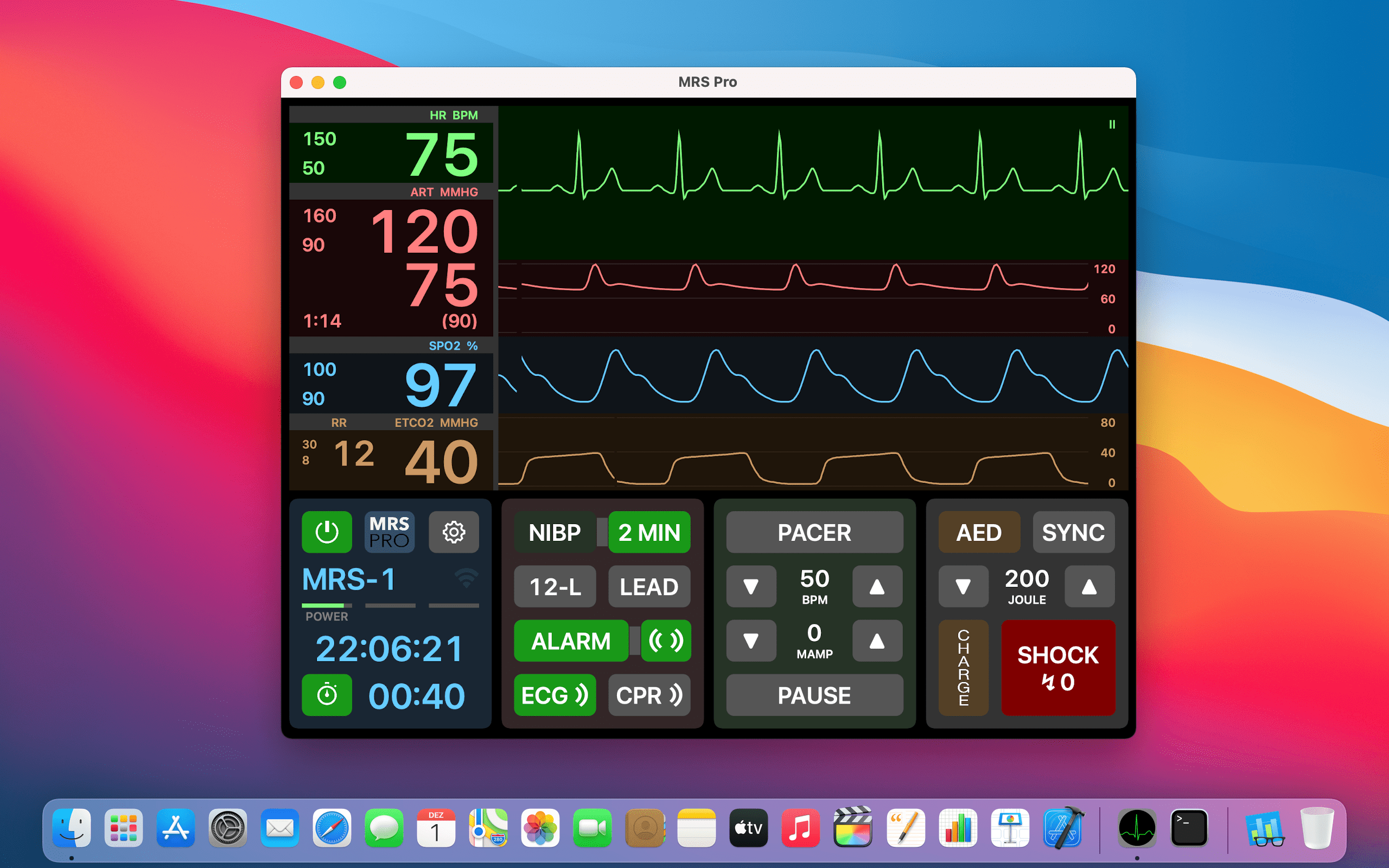 ECG simulations software iOS Apple