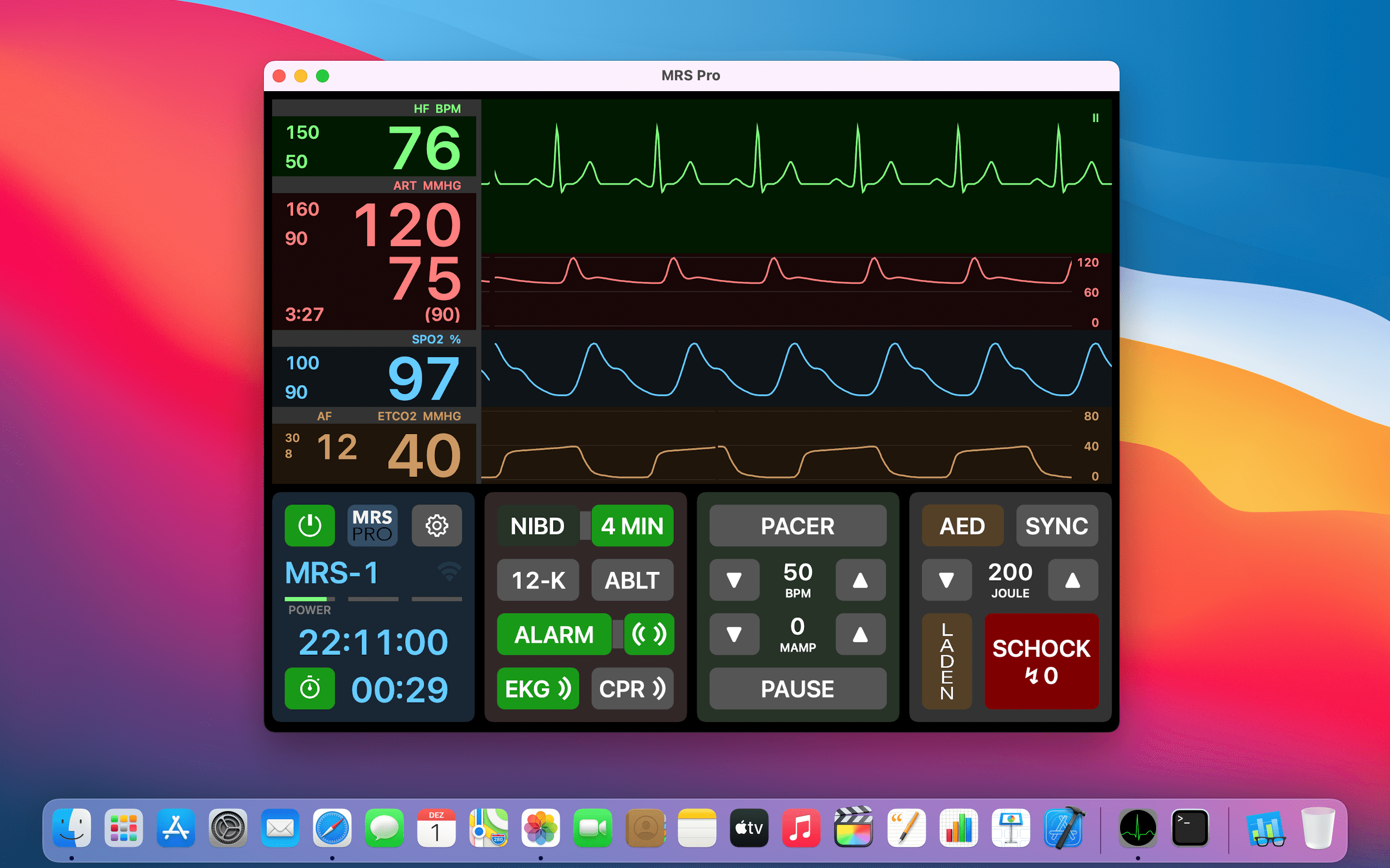 EKG App Software iOS Kompatibilität